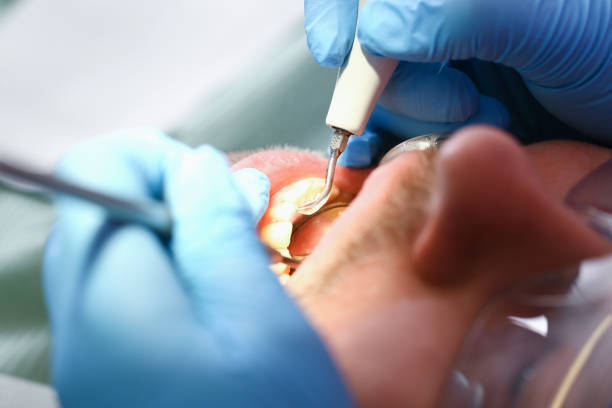 Best Weekend Emergency Dentist in Ness City, KS