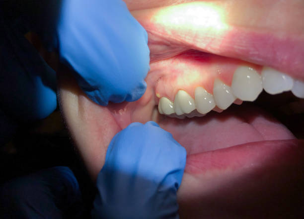 Best Emergency Orthodontic Repairs in Ness City, KS