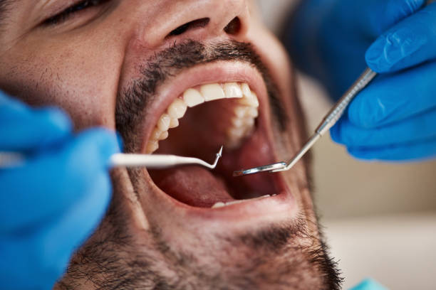 Best Emergency Dental Surgery in Ness City, KS